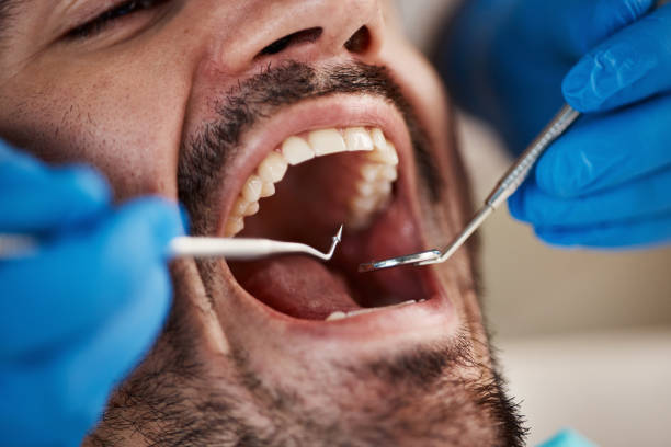 Oral Cancer Screening in West Salem, OH